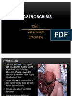 Gastroschisis