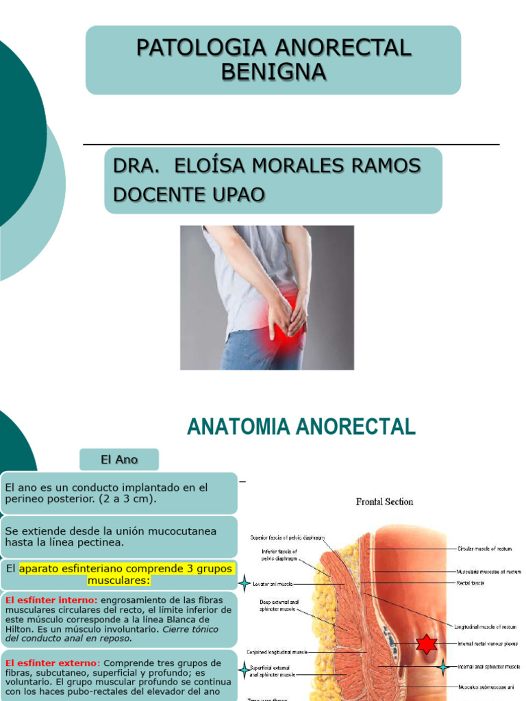 Anatomía y Patología Anorrectal Benigna | PDF | Hemorroides | Recto