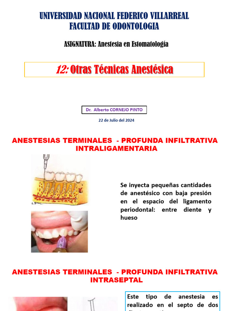 Técnicas De Anestesia Dental Avanzadas Pdf Odontología Medicina