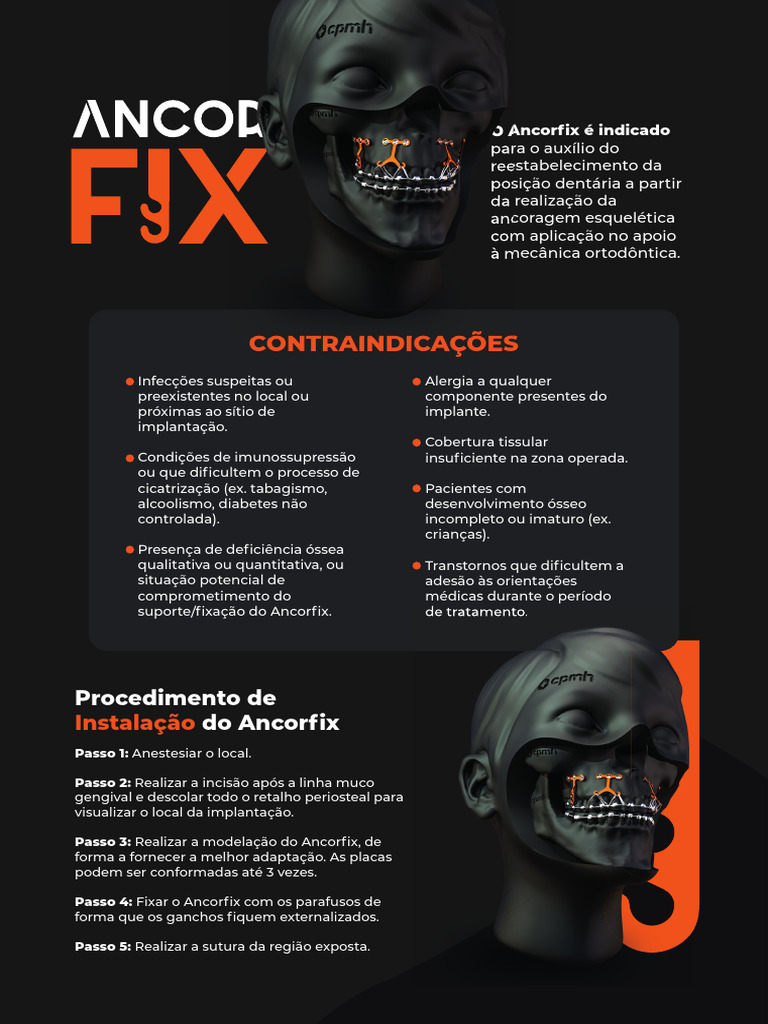 Instalação do Ancorfix: Passo a Passo e Cuidados | PDF | Infecção ...
