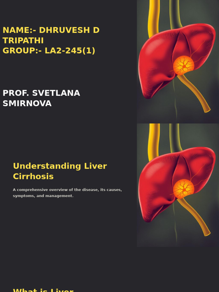 Liver Cirrhosis Overview and Management | PDF | Cirrhosis | Hepatitis