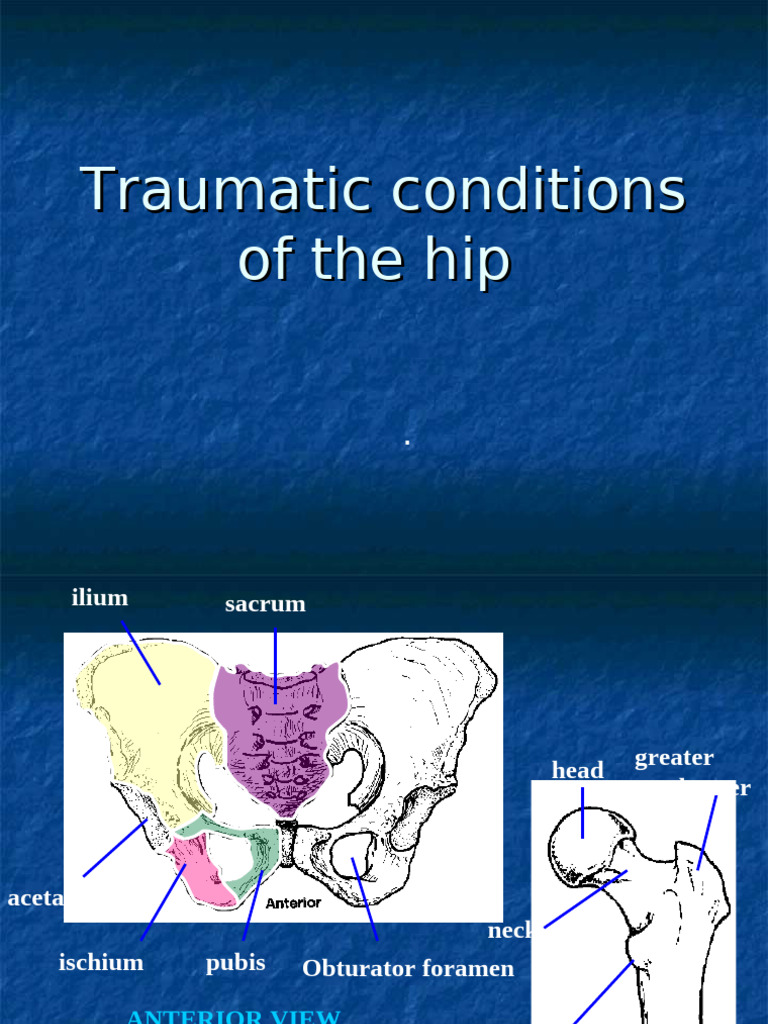 Traumatic Conditions of The Hip | PDF | Hip | Musculoskeletal System