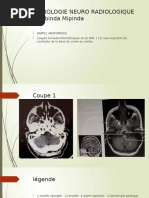 Atlas de radioanatomie du rocher | PDF | Anatomie | Sens (physiologie)