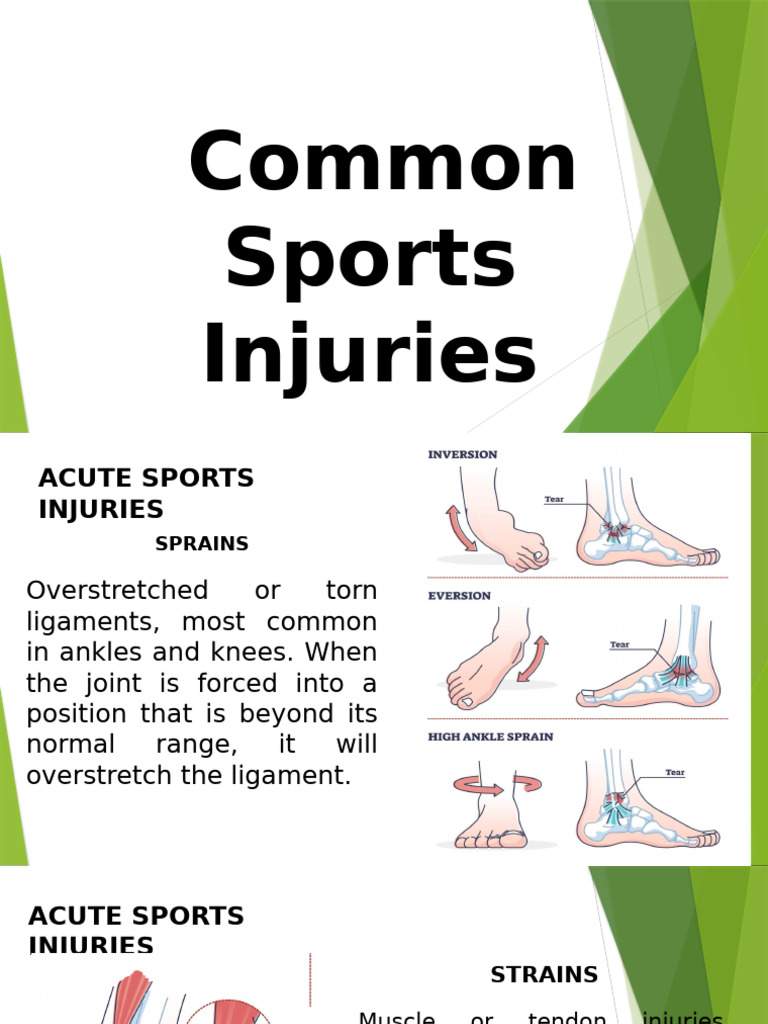 Common Sports Injuries Explained | PDF | Foot | Biomechanics
