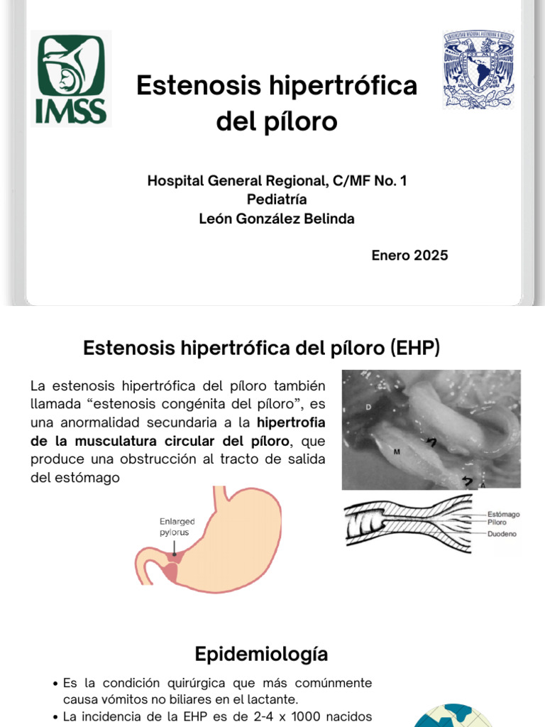 Estenosis Hipertrófica del Píloro | PDF | Vómitos | Bilis