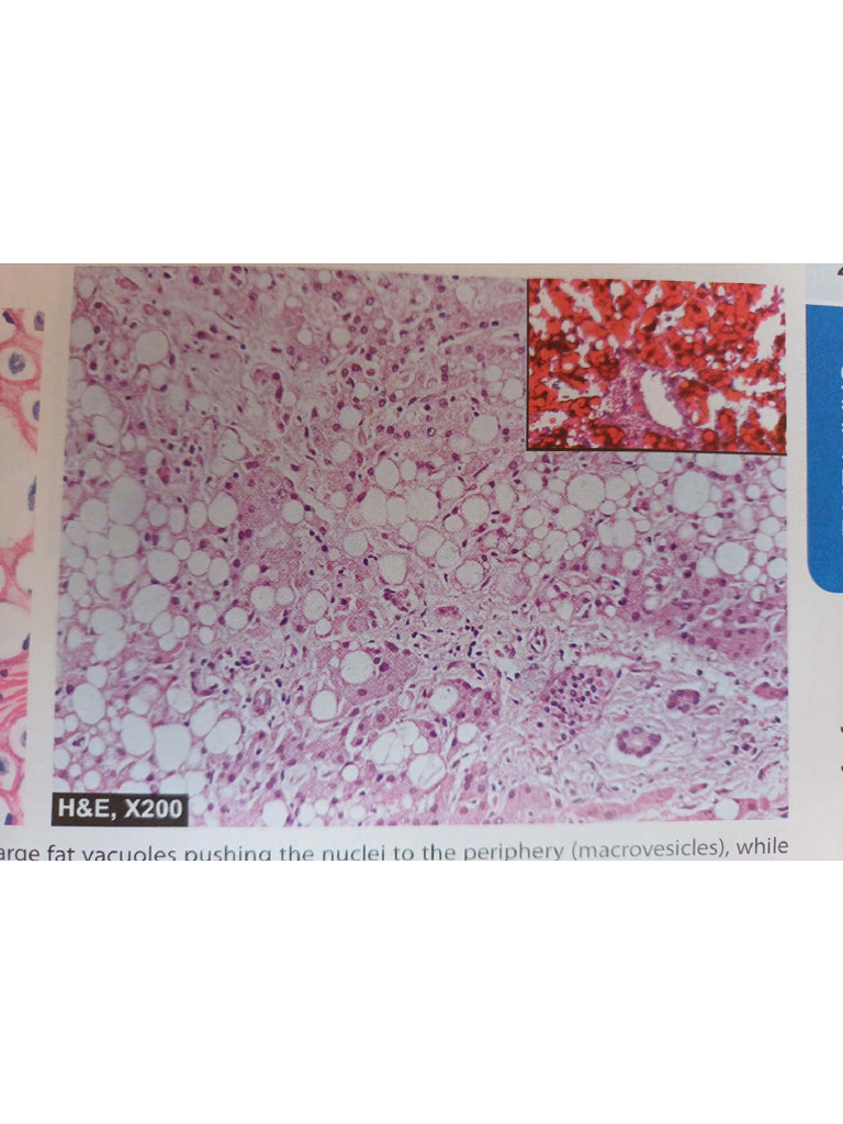 Patho Histopath | PDF