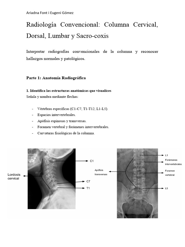 Radiología de la Columna Vertebral: Guía Completa | PDF | La columna ...
