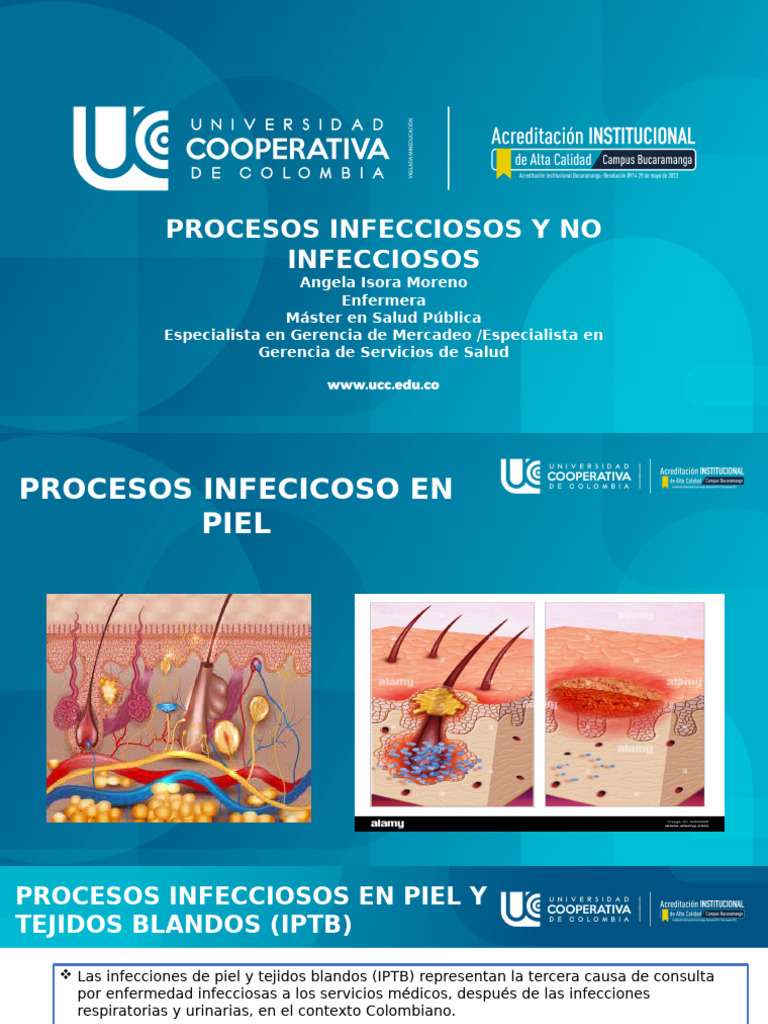 Infecciones de Acuerdo Al Sistema Afectado | PDF | Meningitis | Infección