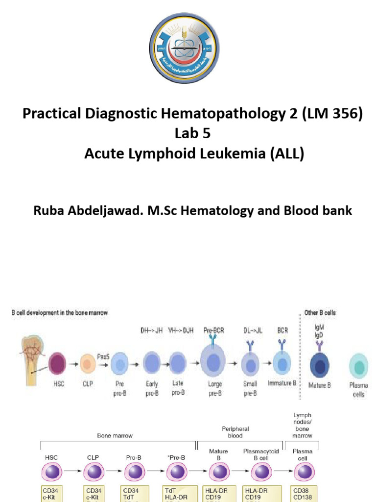 Lab 5 Acute Lymphoid Leukemia | PDF