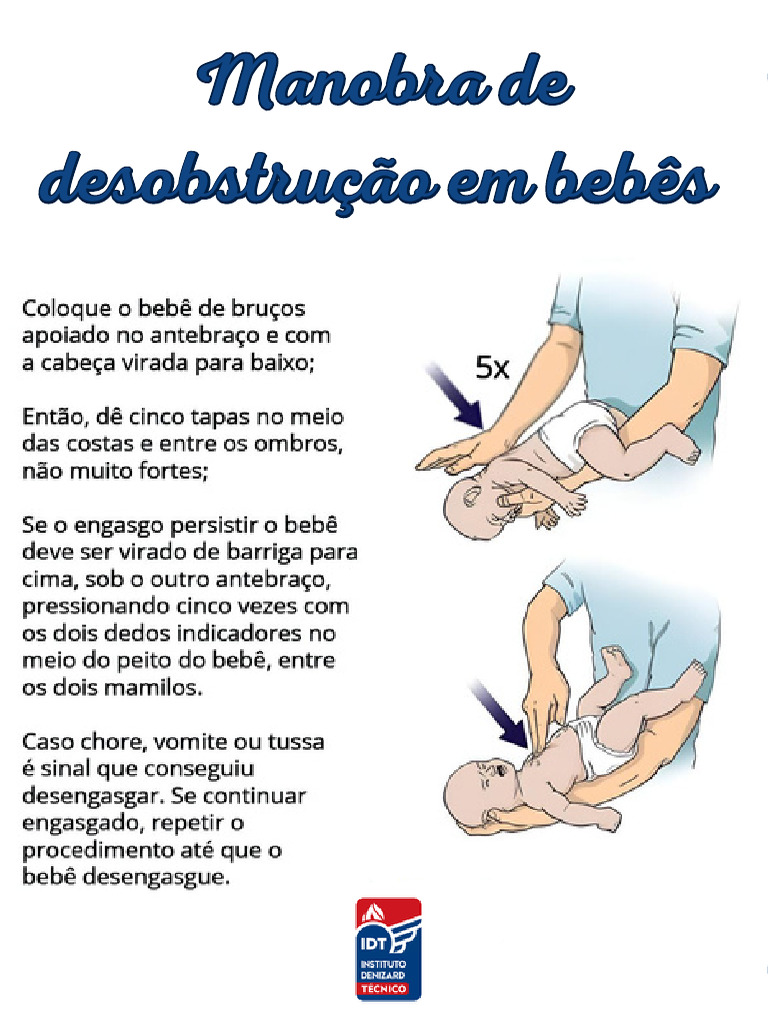 Manobra de Desobstrução em Bebês | PDF