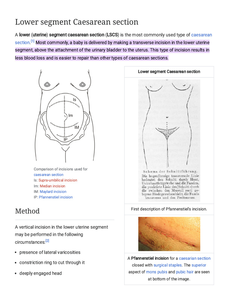 Lower Segment Caesarean Section - Wikipedia | PDF | Medical Specialties