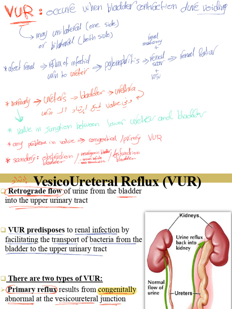محمد نعيم Uti الثاني | PDF | Edema | Urinary System