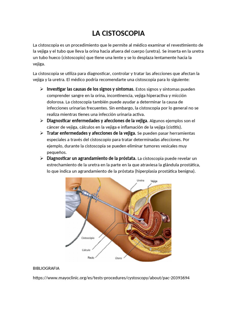Procedimientos de Cistoscopia, Laparoscopia y Broncoscopia | PDF ...