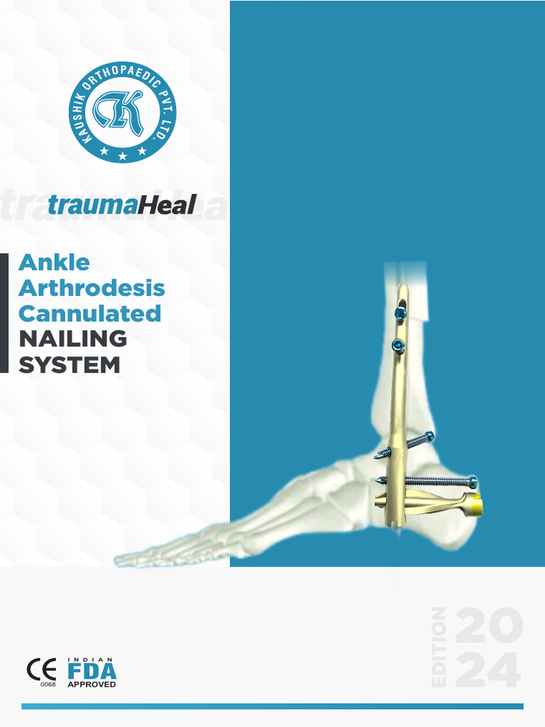 Ankle Arthrodesis Cannulated Nail System | PDF | Screw | Drill