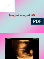 Imagini Ecograf 3D