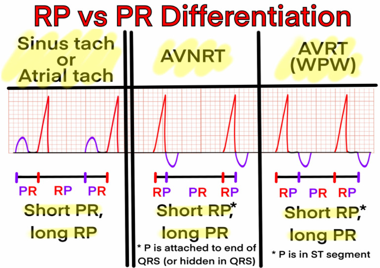RP Vs PR Differentiation-JenniferJeboda20200716 | PDF
