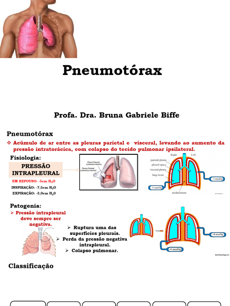 Pneumotórax: Causas, Sintomas e Tratamento | PDF | Sistema respiratório ...