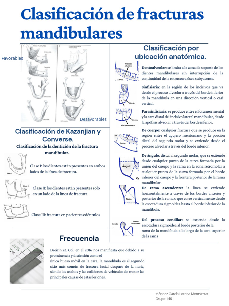 Clasificación de fracturas mandibulares | PDF
