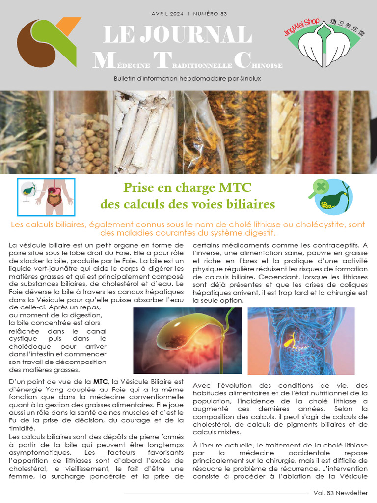 Prise en charge MTC des calculs biliaires PDF Vésicule biliaire — free download