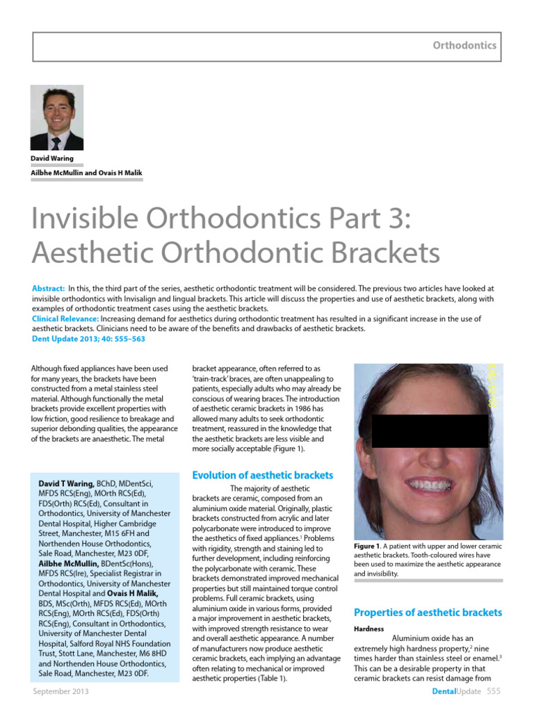 Aesthetic Orthodontic Brackets Overview | PDF | Orthodontics ...