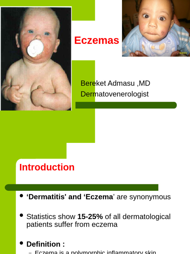 Understanding Eczema: Types and Treatments | PDF | Dermatitis | Medical ...