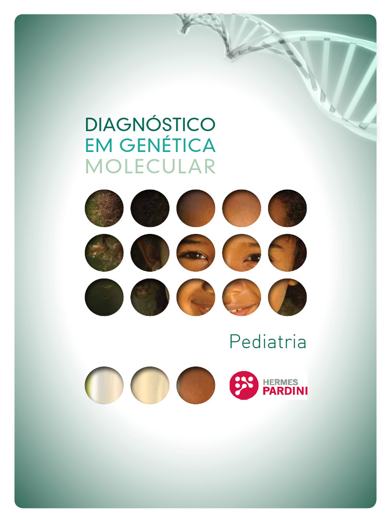 Diagnóstico Genético em Pediatria | PDF | Distrofia muscular | Genética