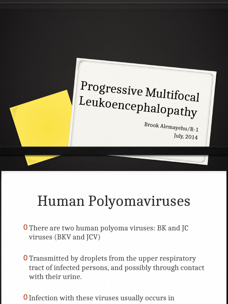 Progressive Multifocal Leukoencephalopathy | PDF | Infection | Virus