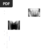 Tönnis Classification of Hip Dysplasia | PDF | Science & Mathematics