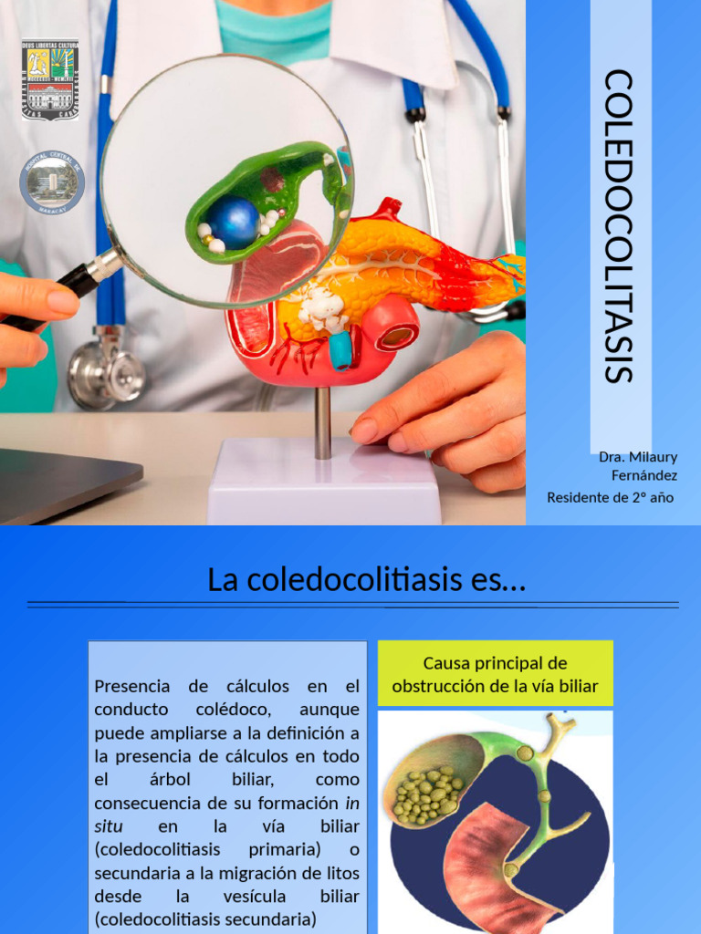 Coledocolitiasis: Diagnóstico y Tratamiento | PDF | Enfermedades y ...