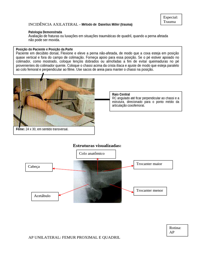 Incidências Radiográficas do Quadril | PDF | Joelho | Sistema Locomotor