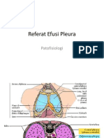 Referat Efusi Pleura