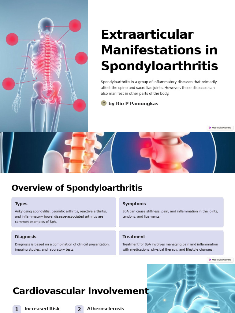 Extraarticular Effects of Spondyloarthritis | PDF | Medical Specialties ...
