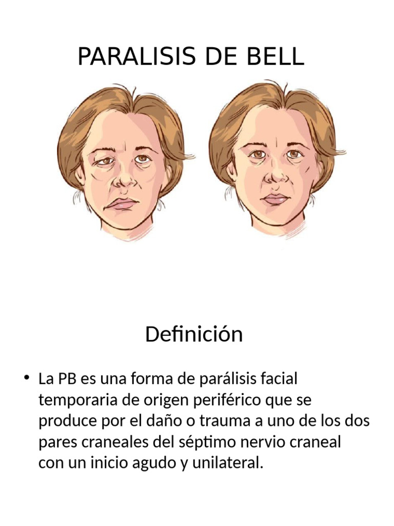 paralisis-de-bell-pdf-especialidades-medicas-anatom-a-humana
