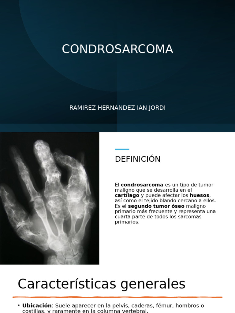 Cond Ro Sarcoma | PDF | Sarcoma | Especialidades Medicas