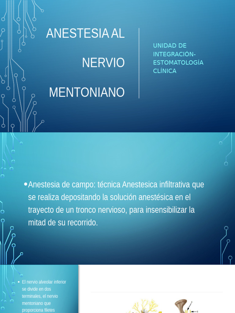 Anestesia Nervio Mentoniano 2024 | PDF | Anestesia | Especialidades Medicas