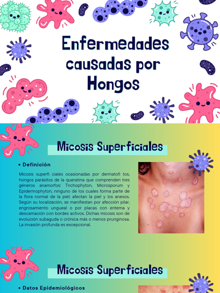 Micosis Superficiales y Subcutáneas | PDF | Sistema inmune ...