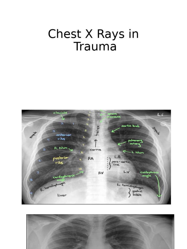 X Rays in Trauma | PDF