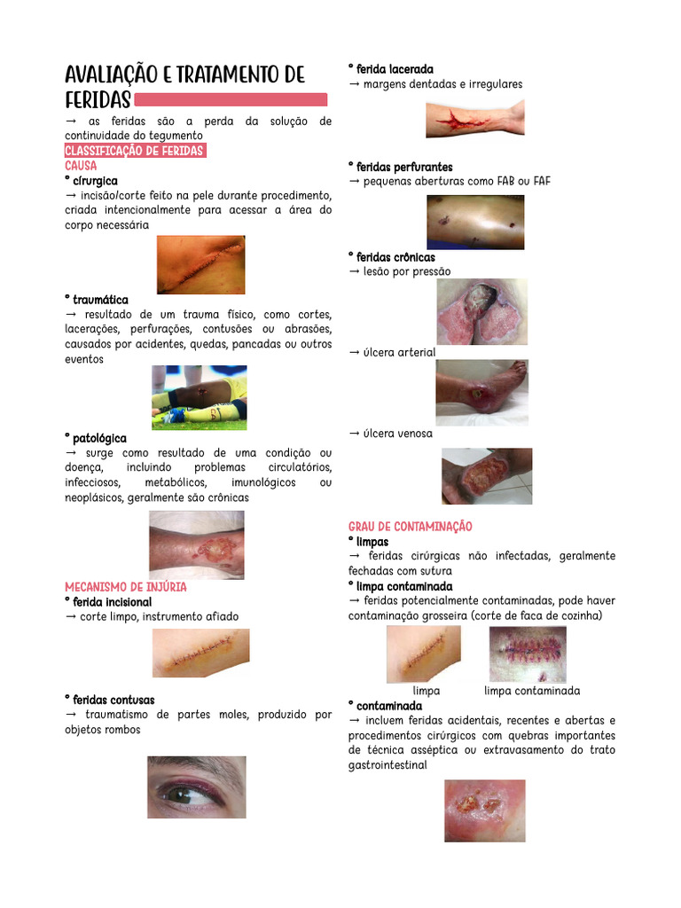 Avaliação e Tratamento de Feridas | PDF | Cura | Pele