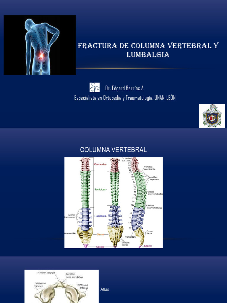 Lumbalgia y Fracturas de Columna Vertebral | PDF | Dolor lumbar | La ...