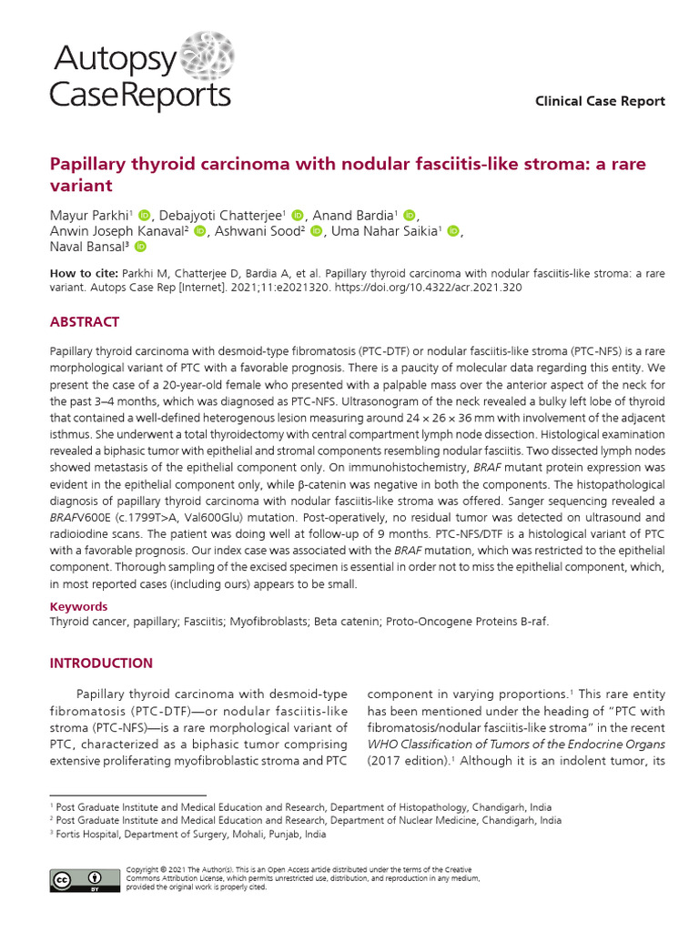 Papillary Thyroid Carcinoma With Nodular Fasciitis | PDF | Carcinoma ...