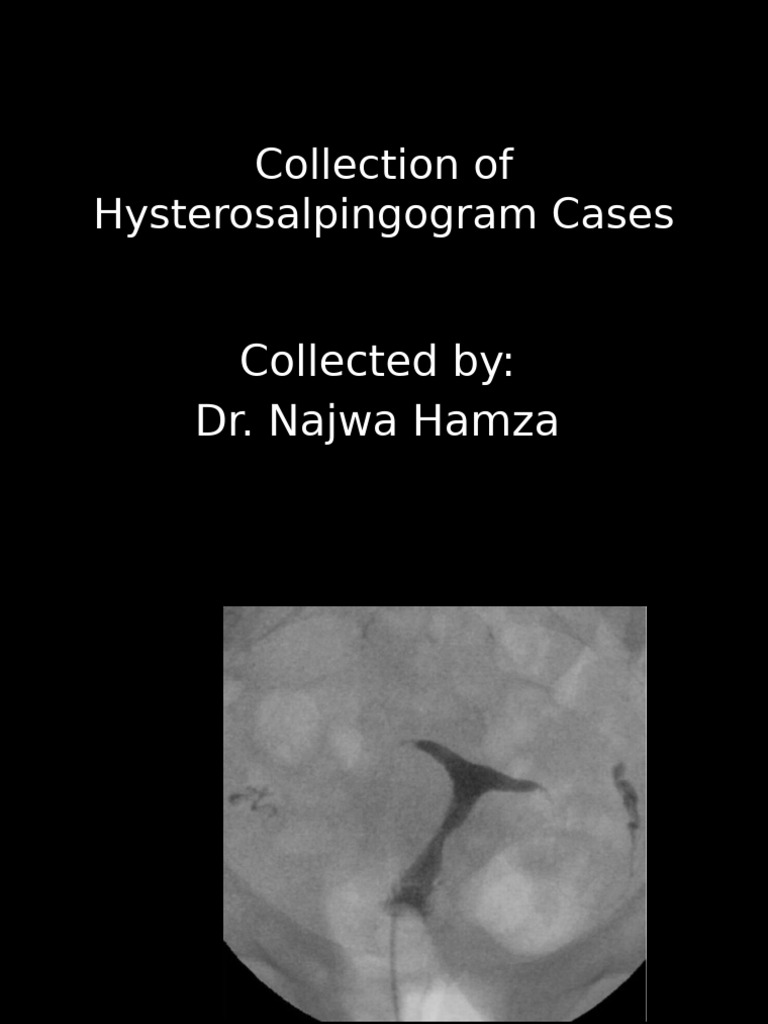 Collection of Hysterosalpingogram Cases-3 | PDF | Uterus | Mammal ...