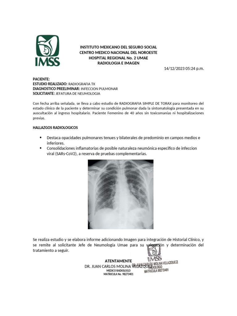 Radiografía de Tórax: Infección Pulmonar | PDF