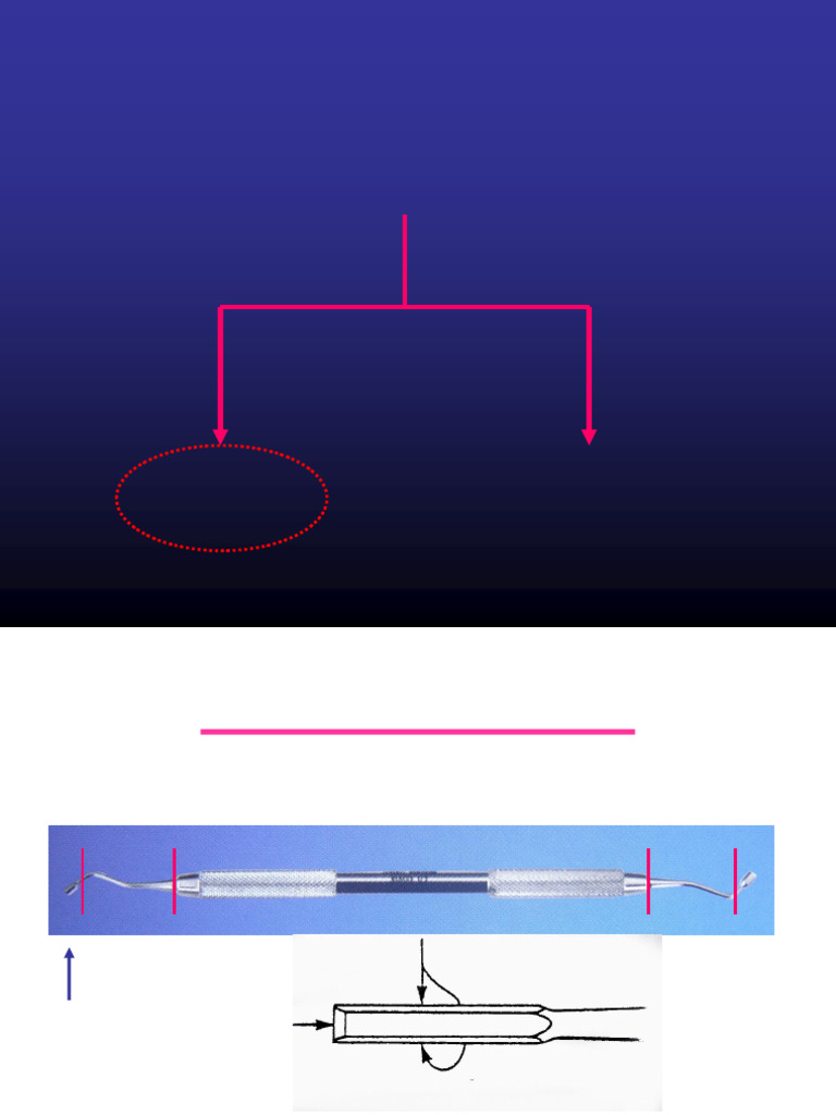 Gingival Marginal Trimmer Overview | PDF | Anatomical Terms Of Location ...