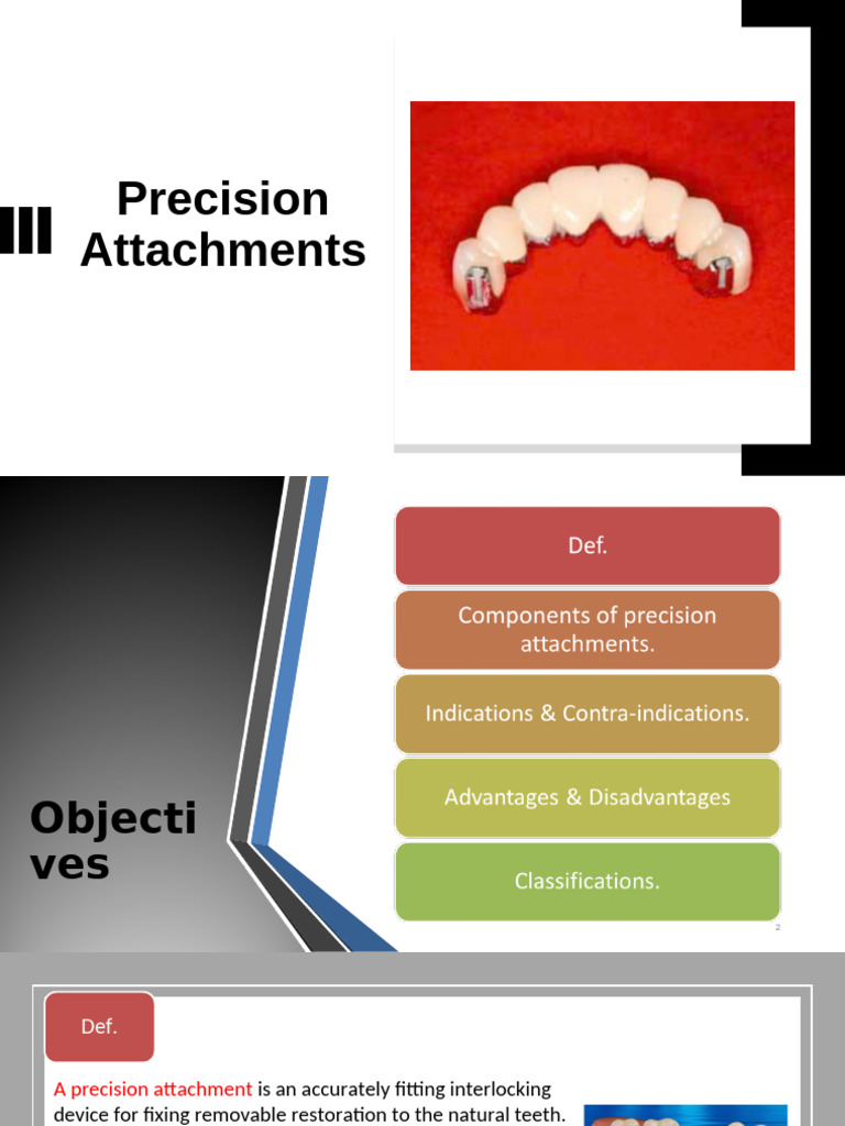 Precision Attachments in Dental Prosthetics | PDF | Dentures ...