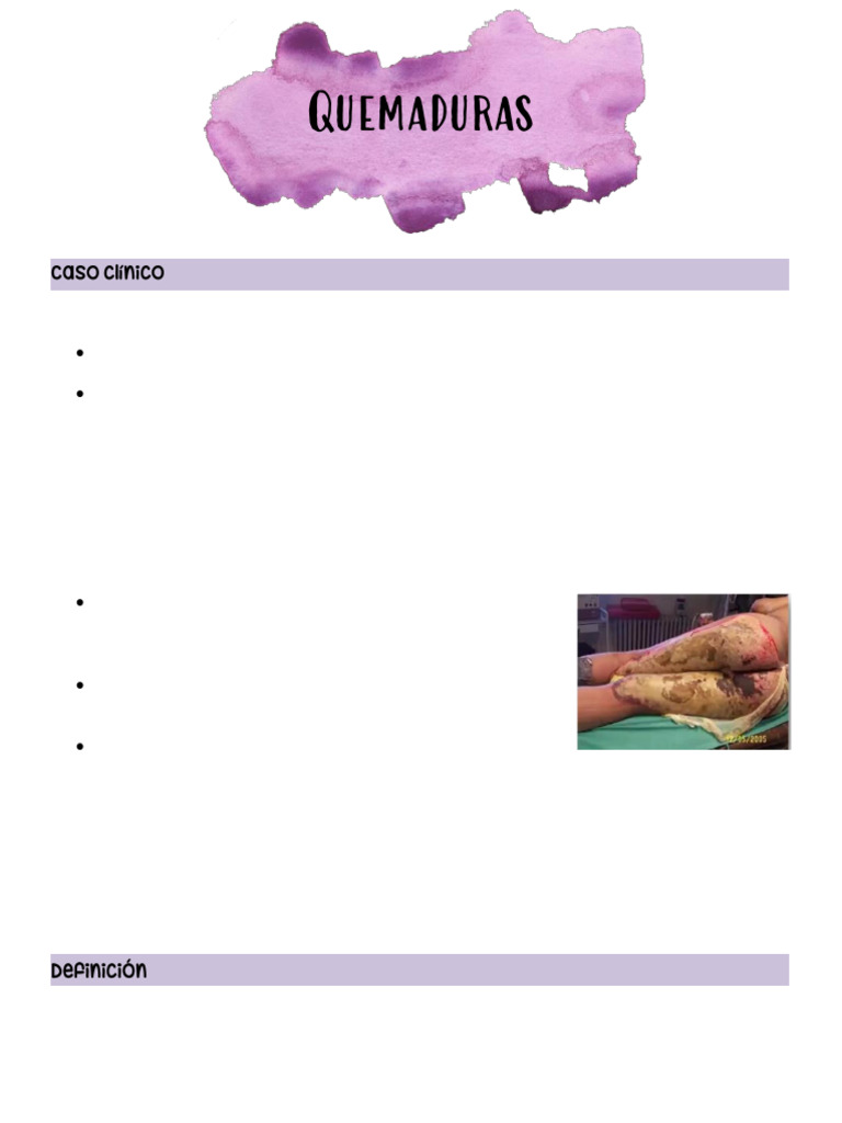 Manejo y Clasificación de Quemaduras | PDF | Quemar | Analgésico