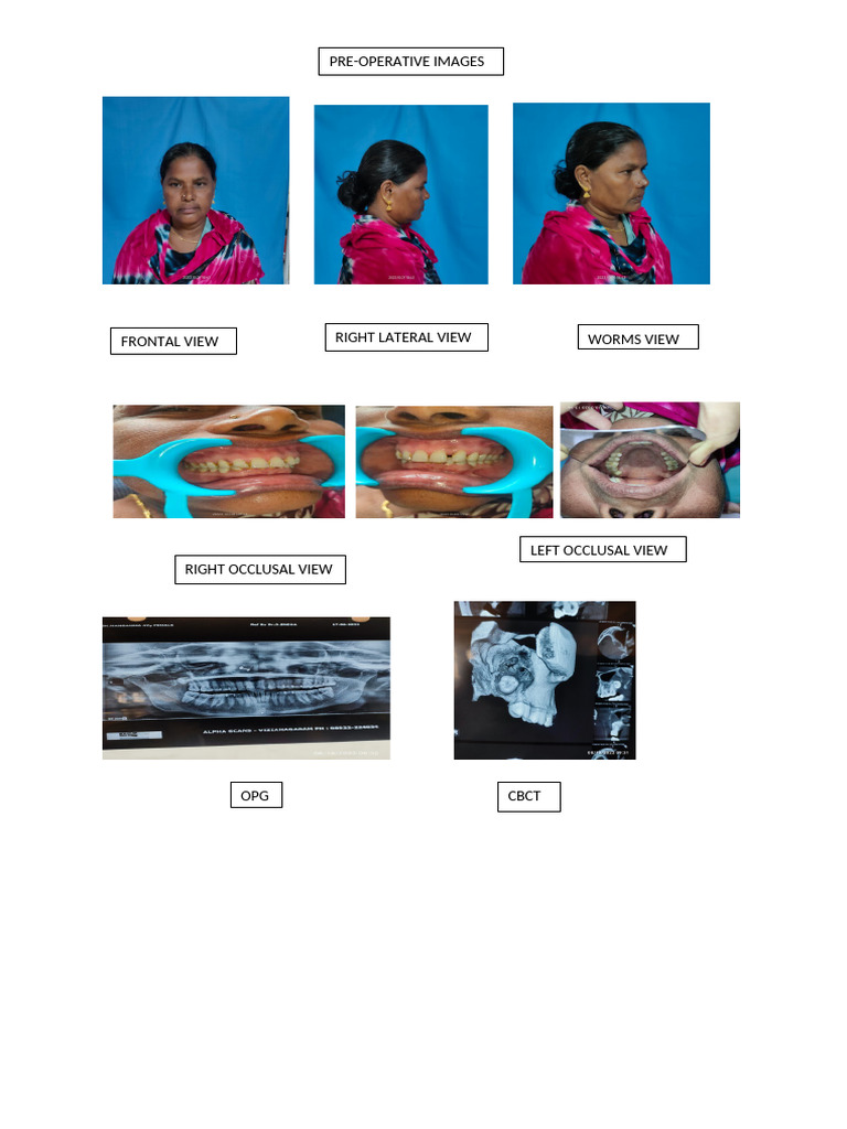 Mangamma Arragment | PDF