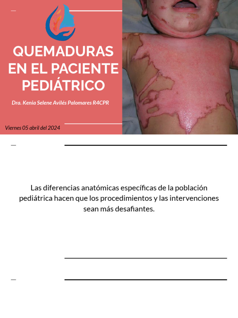 Manejo de Quemaduras en Niños | PDF | Quemar | Medicina