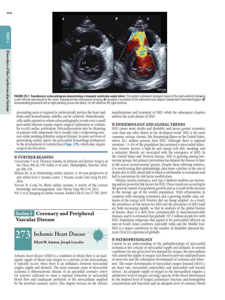 Ischemic Heart Disease | PDF | Ischemia | Coronary Artery Disease