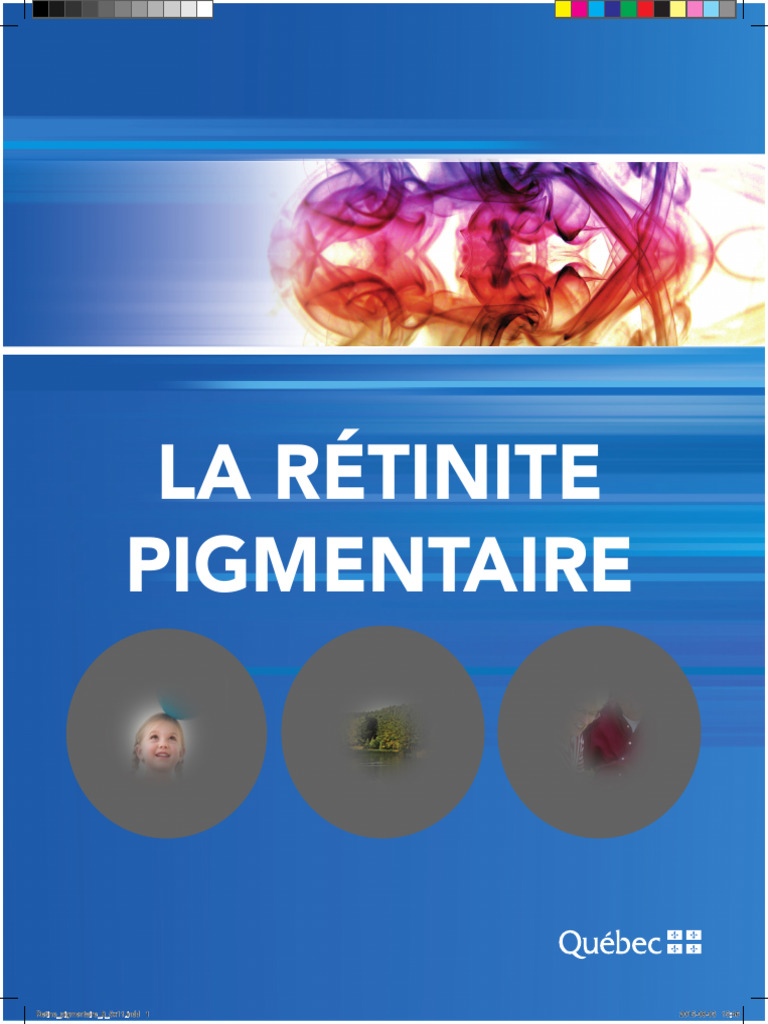 Solutions et traitements rétinite pigmentaire | PDF | Œil humain ...
