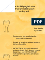 Radiološki Pregled Zuba